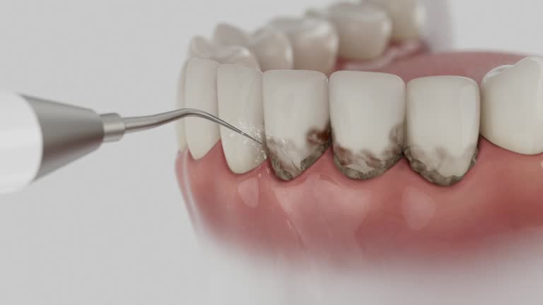 Trusted Teeth Cleaning And Checkup service in Pendleton, SC - Dentist Open Now